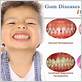 signs of gum disease in child