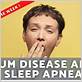 sleep apnea gum disease