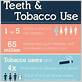 smoking and gum disease facts
