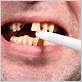 smoking pipes leads to gum disease