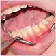 smyrna gum disease treatment