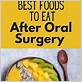 soft food diet after dental surgery when you cant chew