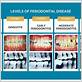 stamford periodontal gum disease