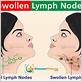 swollen lymph nodes gum disease