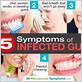 symptoms of a gum infection
