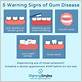 symptoms of gum disease nhs