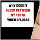 teeth bleed when water flossing