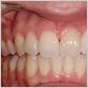 teeth gum health