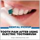 teeth hurt after using electric toothbrush