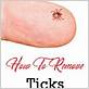 tick removal dental floss