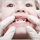 tooth decay or gum disease when wearing braces