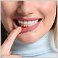tooth implant gum disease myalgias