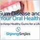 treatment and prevention of diseases of the gums specialist