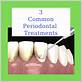 treatment for periodontitis at home