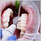 treatment of gum disease philadelphia