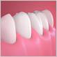 treatment of periodontal gum disease in cornwall