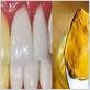 turmeric paste can kill gum disease bacteria