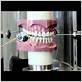 u of mn dental school chewing machine