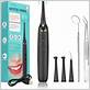 ultrasonic teeth cleaning reviews