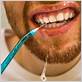 use waterpik periodontal disease