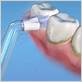 using a waterpik to remove hard plaque