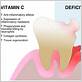 vitamin c and d for gum disease