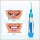 water floss whiter teeth