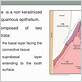 waterpik damage junctional epithelium ncbi