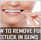 waterpik food stuck in gums