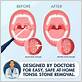 waterpik to get rid of tonsil stones