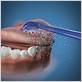 waterpik water flosser tongue cleaner tip replacement