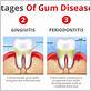 waverly gum disease