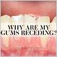what diseases cause your gums to recede