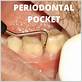 what do periodontal pockets look like