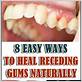 what is the best way to clean gum disease