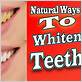 what is the best way to get white teeth