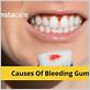 what makes your gums bleed