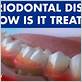 why can't periodontitis be cured