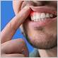 woodland hills gum disease treatments